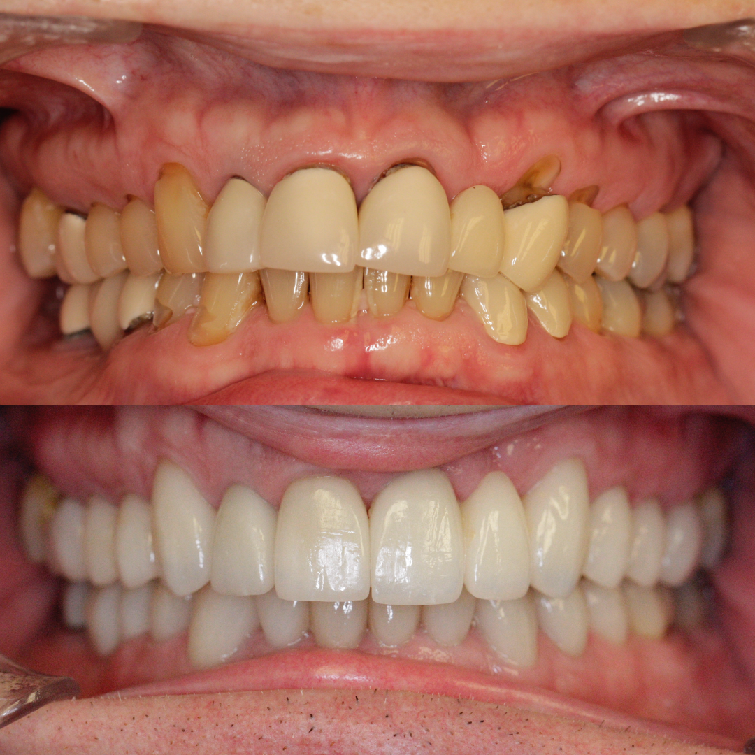 Midlothian-Dentist-Smile-Design